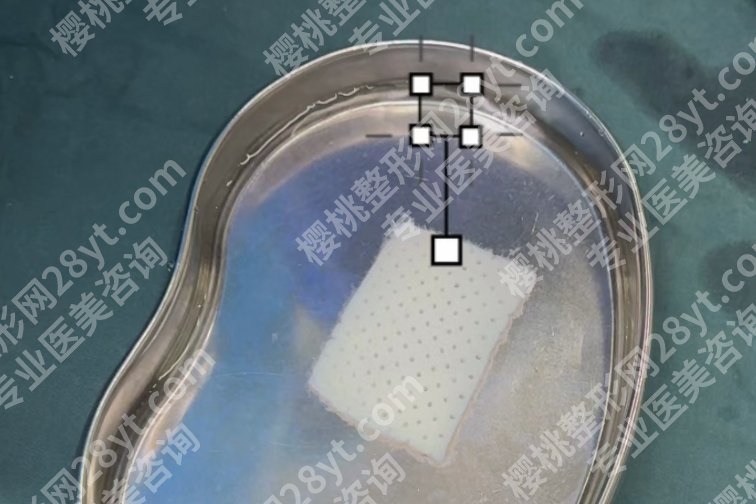 生物补片十大后遗症,真有那么神?今天告诉你真相