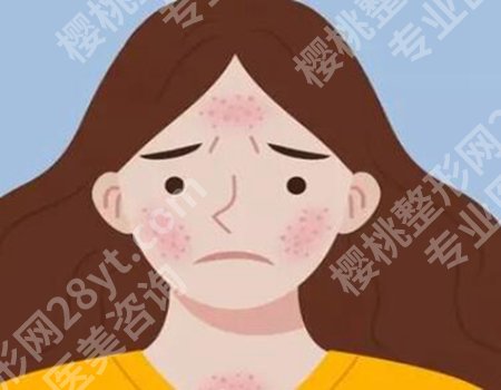 点阵激光3次痘坑全没有了？真实案例+适合痘坑类型，效果实测