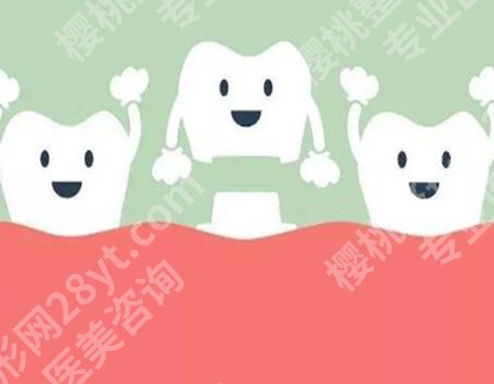 烤瓷牙的种类及价钱怎么样？详细情况一一分析，不要错过哦