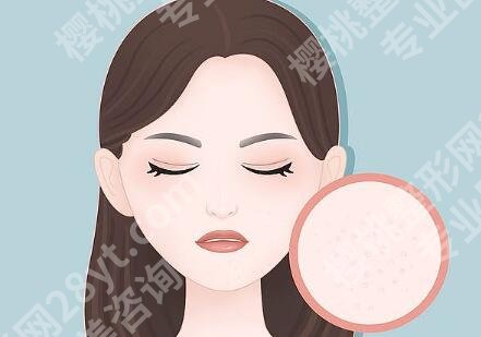 脸部红血丝的方法是什么？4种科学方法，敏感肌快速不反复