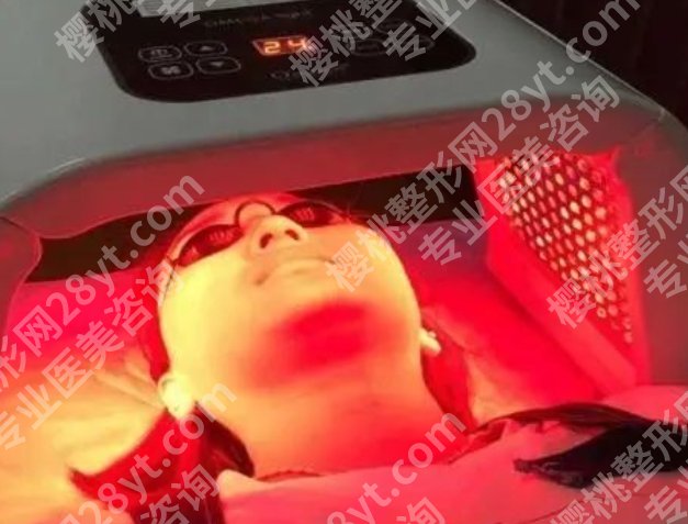 红蓝光祛痘到底有没有效果?灯一打,痘就跑?科学告诉你真相
