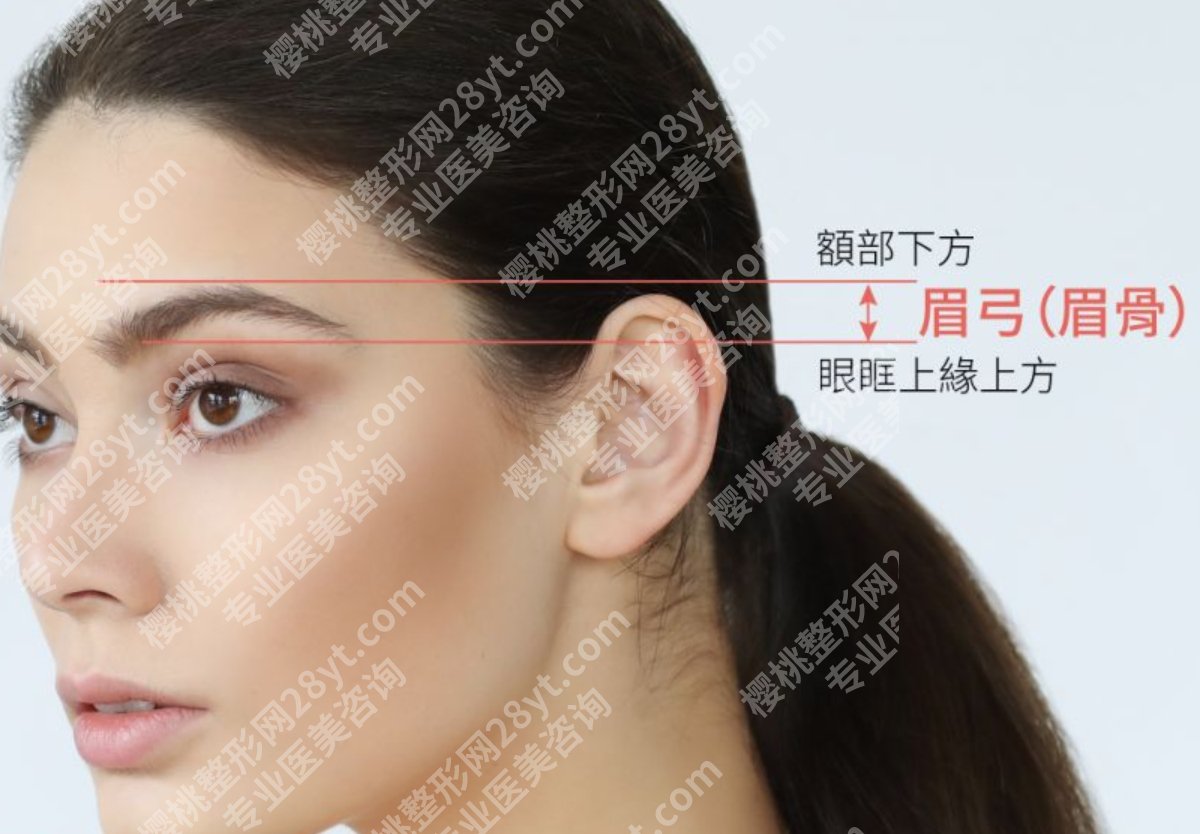 隆眉骨用哪款玻尿酸好？想挺起眉骨，不是所有玻尿酸都能扛得住