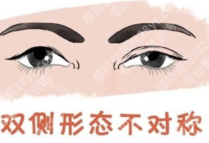 大连孙琳医生做眼修复怎么样？专业资质+手法风格，全面解析修复实力