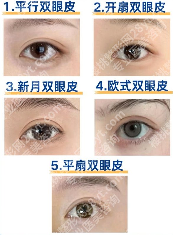 宁波二院双眼皮手术，术前像睁不开眼的社畜｜术后变成回头率99%的野生女明星