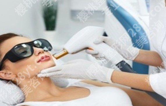 做fotona4D眼睛需要戴护目镜吗？动脸不动眼？护目镜了解一下！