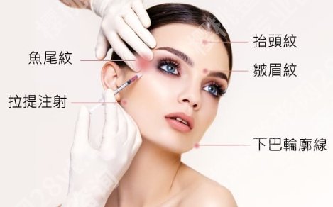 打注射除皱后注意事项，脸刚“抚平”，别让作妖行为把它又“折回去”！
