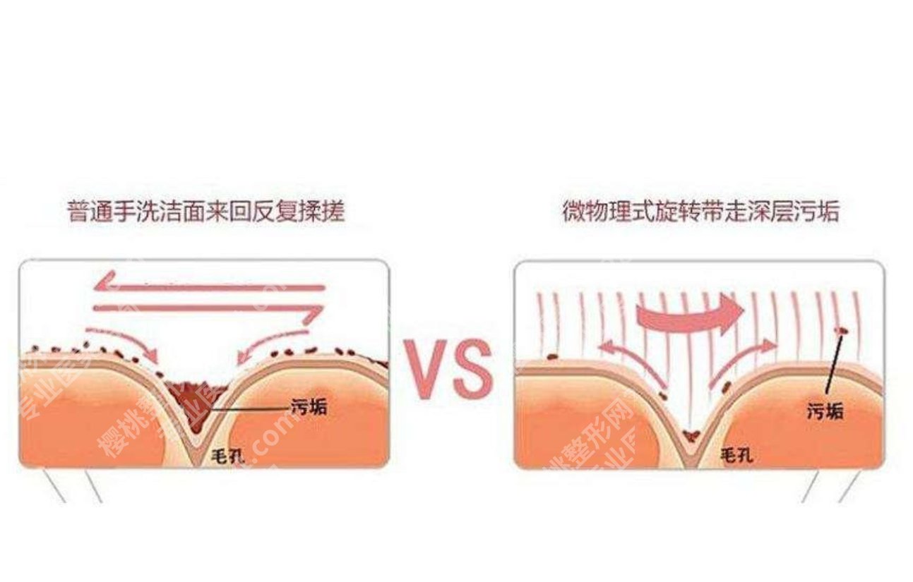 微晶磨削术是什么？微晶一上，旧皮靠边站