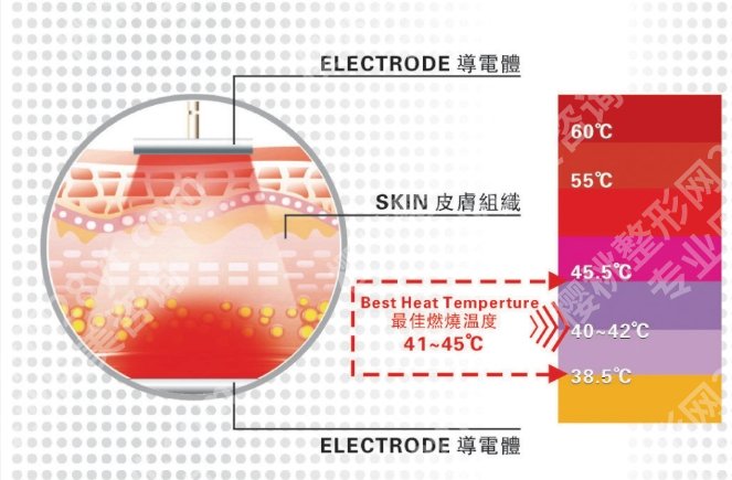 热拉提和水光可以一起做吗？医美常见套餐：热拉提+水光，到底行不行