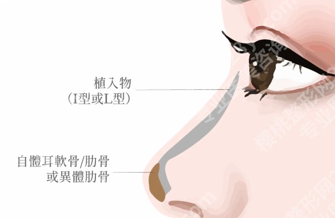 周顺波鼻子案例，鼻子的小改动大不同，给爱美的人又多了一份参考