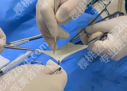 男性生物补片有副作用吗？价格情况和风险信息了解