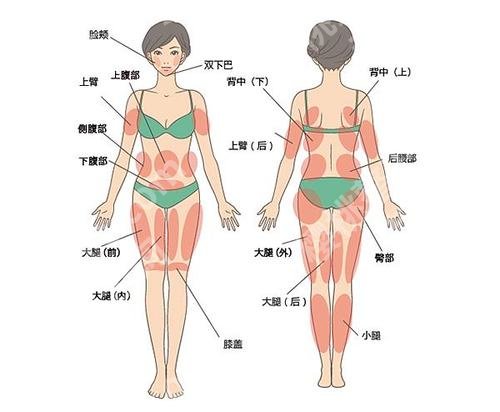 杭州腰腹环吸医生排名速查，马腾\米德傲\严晟等实力在线，1.5万元起