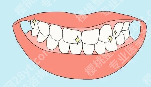北京大学口腔医院正畸费用贵吗？价格参考：21000元起！