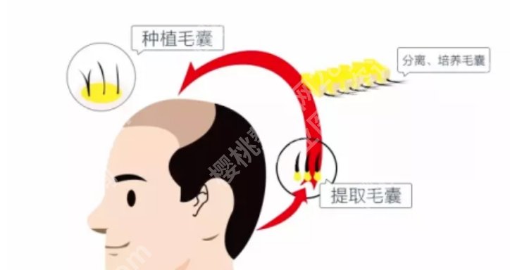 广东省中医院植发医生推荐！康旭、陈达灿、卢传坚等人气颇高！