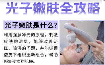 连云港第一人民医院光子嫩肤技术如何？网友真实评价来袭！附案例图