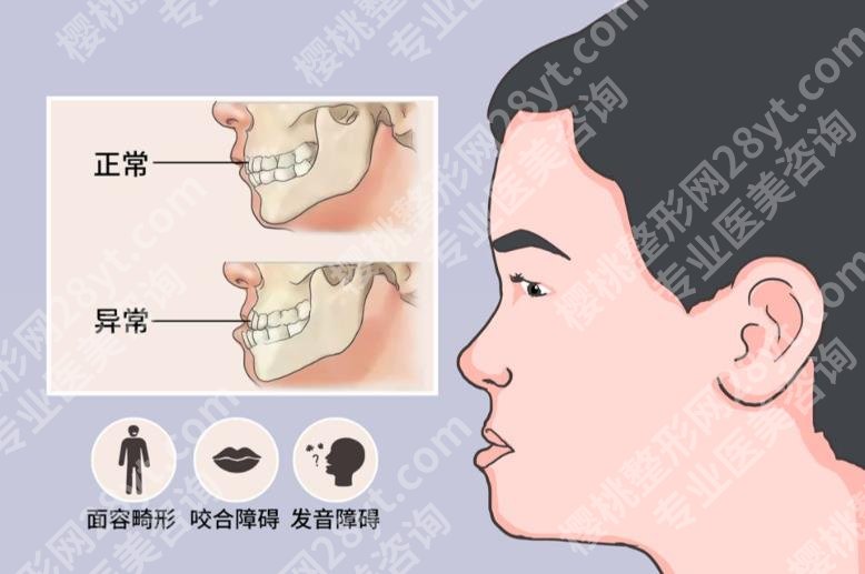 南京正颌手术医生有哪些？孙国文|杜一飞|沈干等5大专家测评！