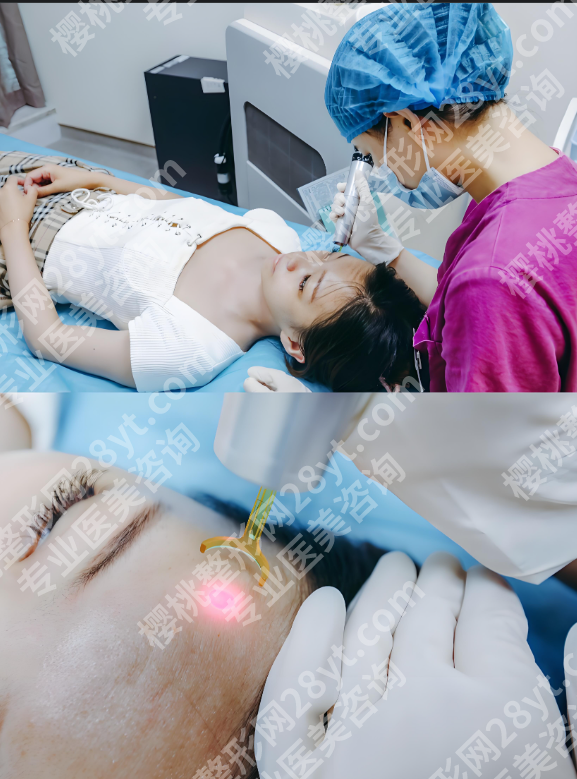 重庆附一院光子嫩肤怎么样？真人案例+挂号攻略，放心冲！