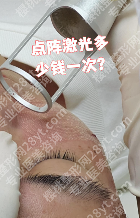武汉第一医院点阵激光多少钱一次？内附真实价目表，看完不花冤枉钱！
