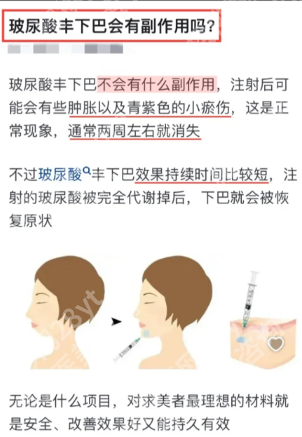 玻尿酸丰下巴有什么副作用？宝子别慌！这篇讲透风险
