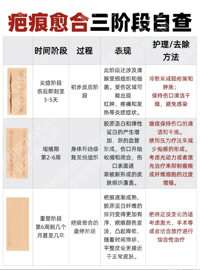 上海华山医院祛疤恢复期多久？三甲医生揭秘3类疤痕的科学修复时间表