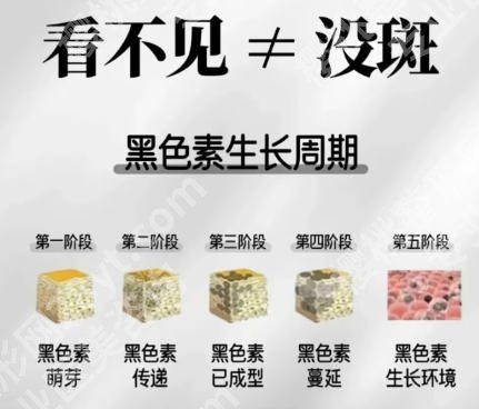 北京协和医院激光祛斑价格贵不贵？医院定价标准附上！点击查看