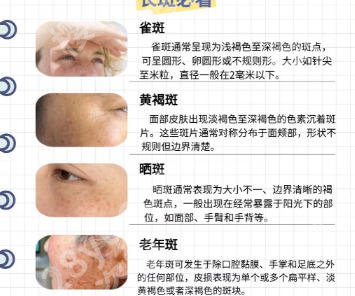 北京大学第一医院光子嫩肤价格贵不贵？整形费用一览