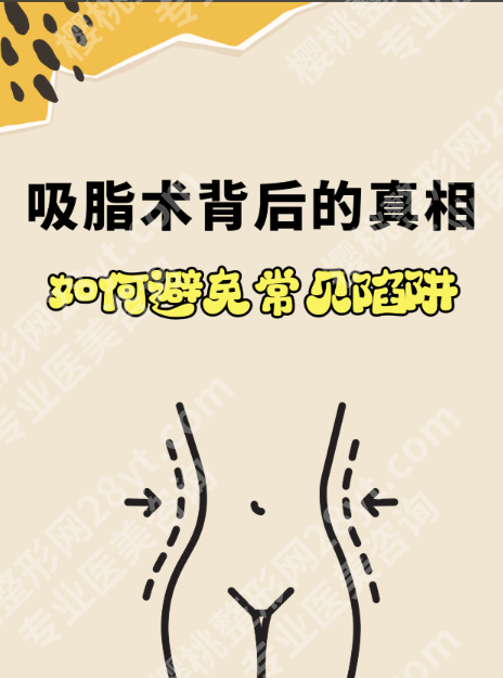 哈尔滨医大一院吸脂实测:设备/价格/案例全解析