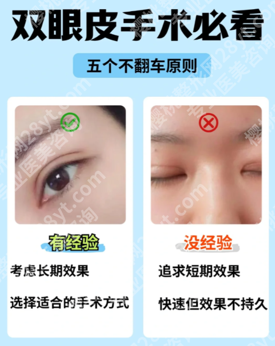 无锡二院割双眼皮全攻略：本地人等2周也要约的医生，效果到底多自然？