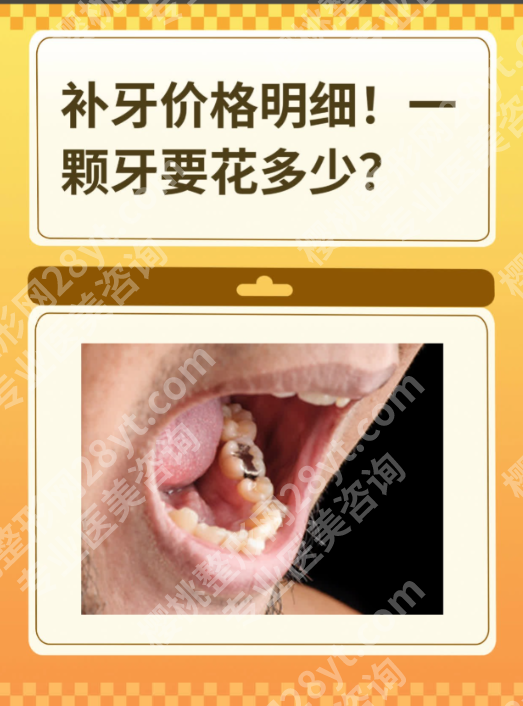 佛山南海人民医院牙科补牙要多少钱?新价格表+避坑指南,本地人都说值