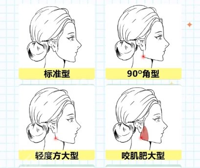 上海华东医院磨骨手术价格贵不贵？项目收费明细参考！