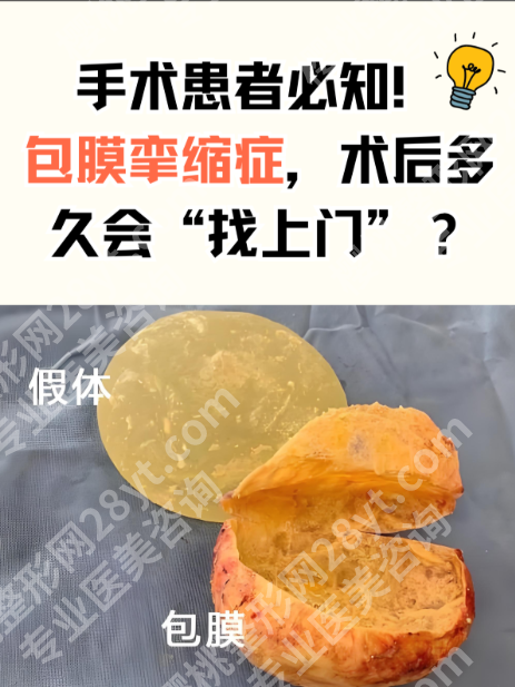 包膜挛缩是什么意思?隆胸/隆鼻后摸出硬块、胸型变形,其实是它在搞鬼!