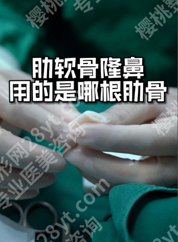 肋软骨隆鼻后肋骨一般多久恢复好?2025新恢复时间表,怕疼怕留疤的姐妹必看!