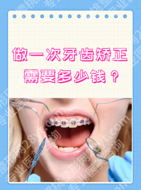 义乌中心医院牙齿矫正多少钱？赶紧来细看费用构成