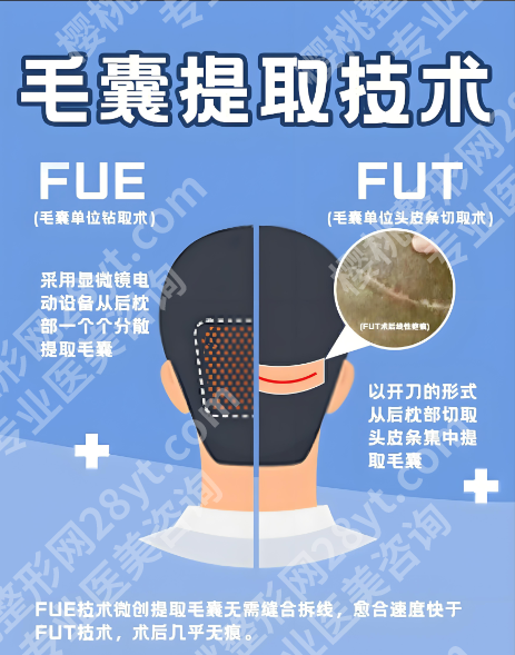 湖南省人民医院植发全解析：从技术到价格，从效果到护理
