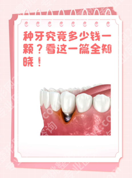 北京医院种牙多少钱一颗？一篇算清“省钱账”！