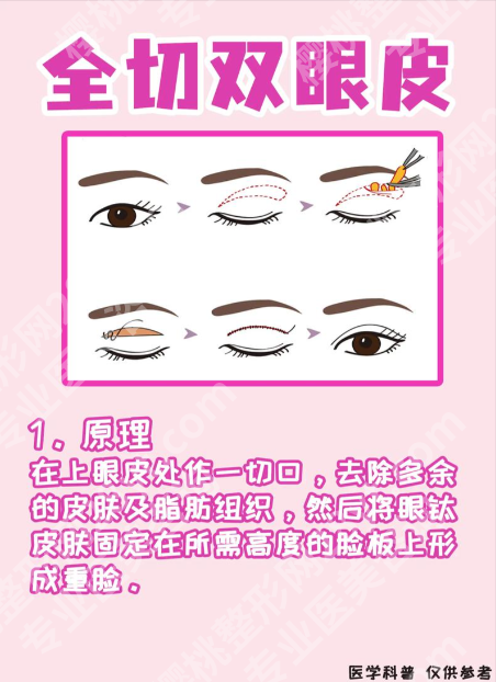 深圳市人民医院割双眼皮:这4个“隐藏优势”,比你刷100条测评还管用!