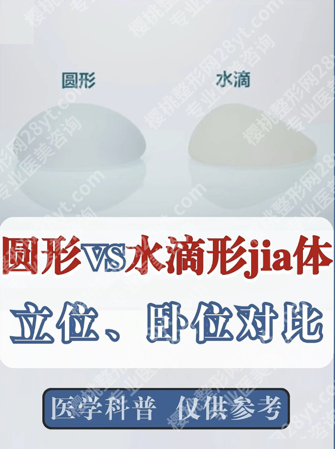 水滴假体和圆形假体哪个好？2025实测对比表+真人案例+选假体攻略