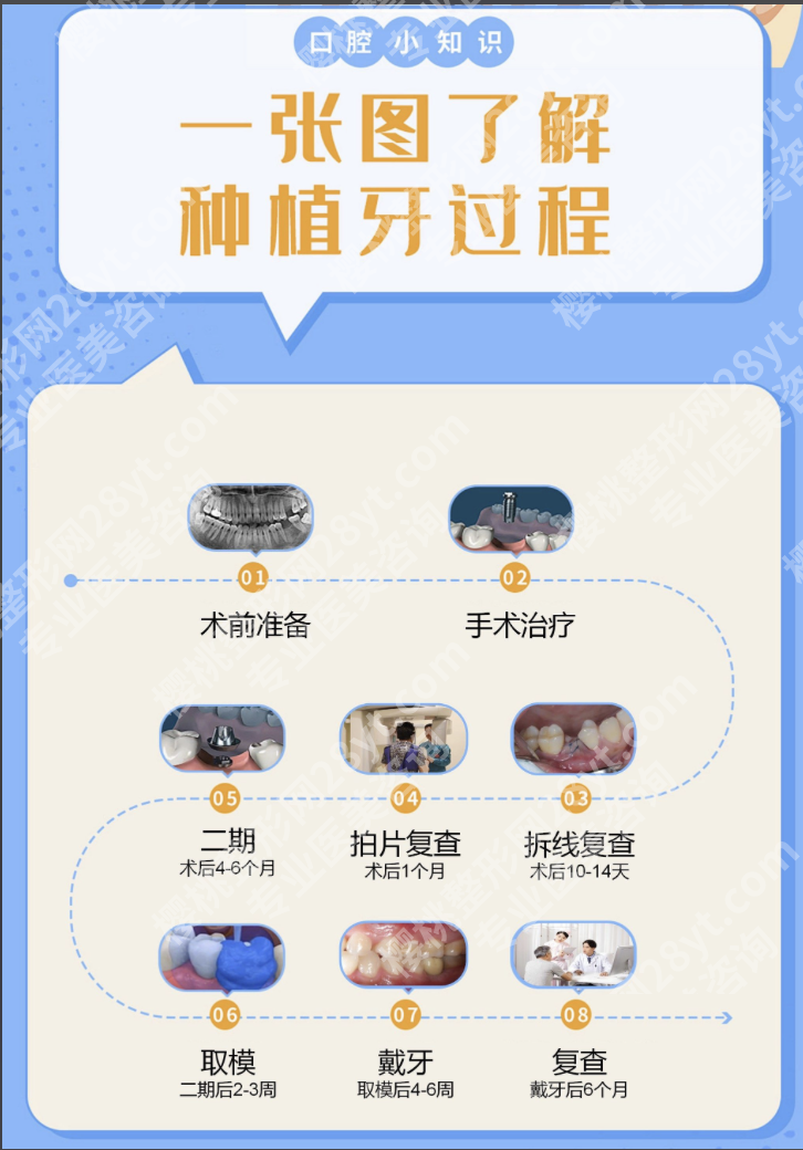 上海华山医院种牙怎么样？2025集采后费用+技术对比+真实案例全攻略