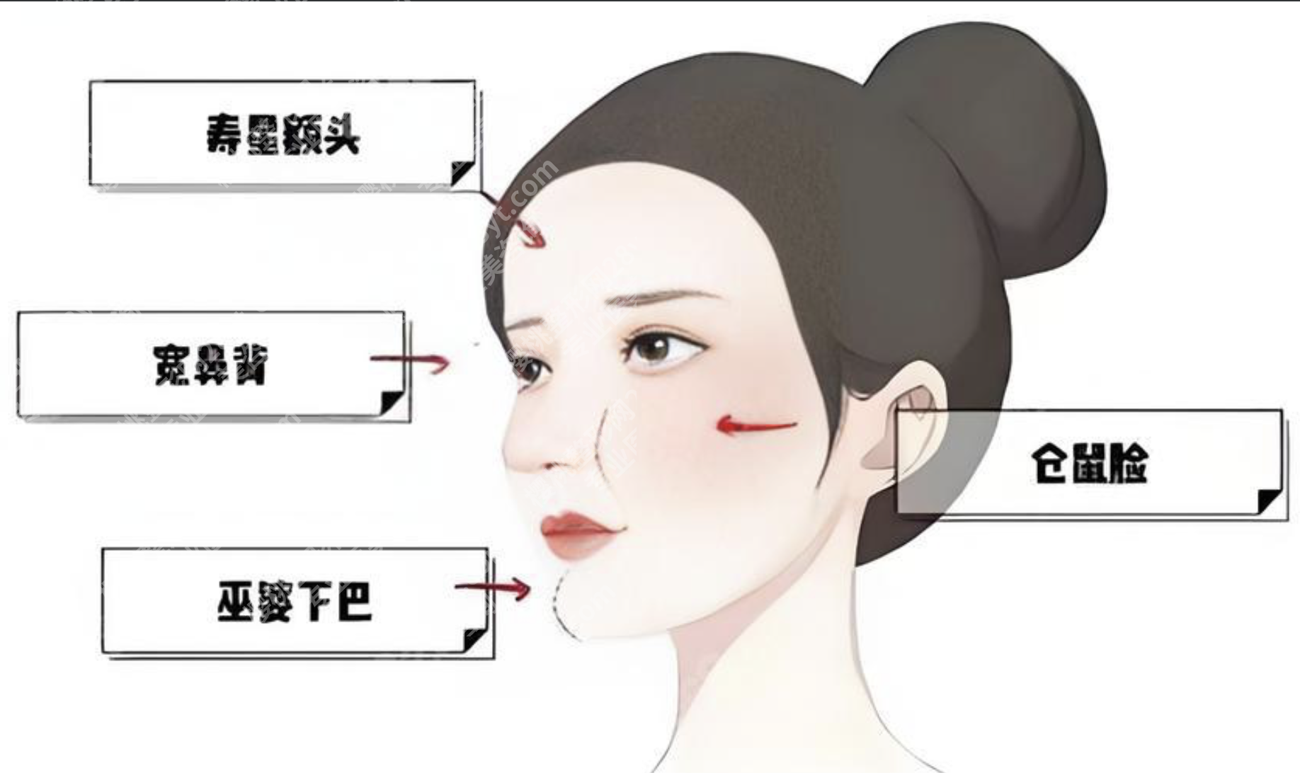 馒化脸修复收紧：从“发面馒头”到自然妈生脸的逆袭指南