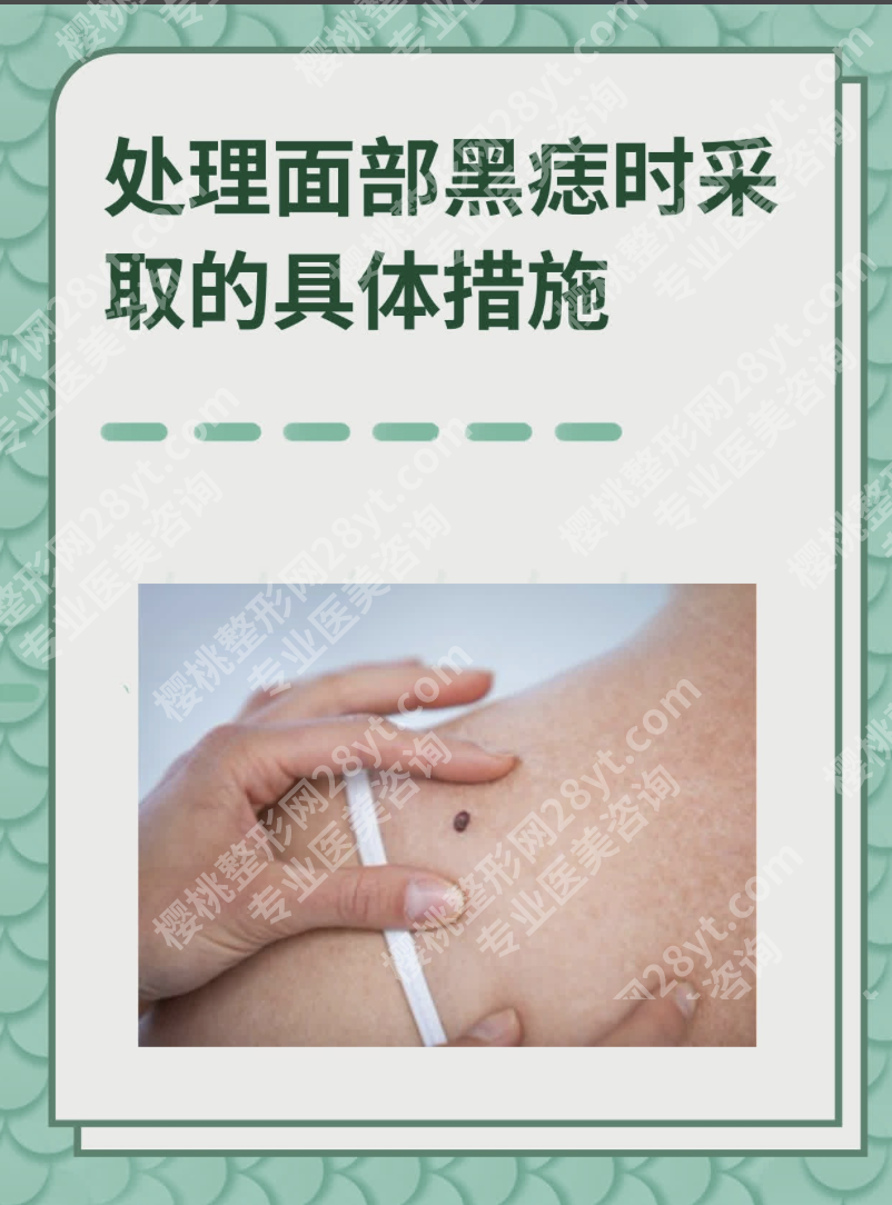 去黑痣有效的方法：从激光到手术，2025年全攻略看这篇