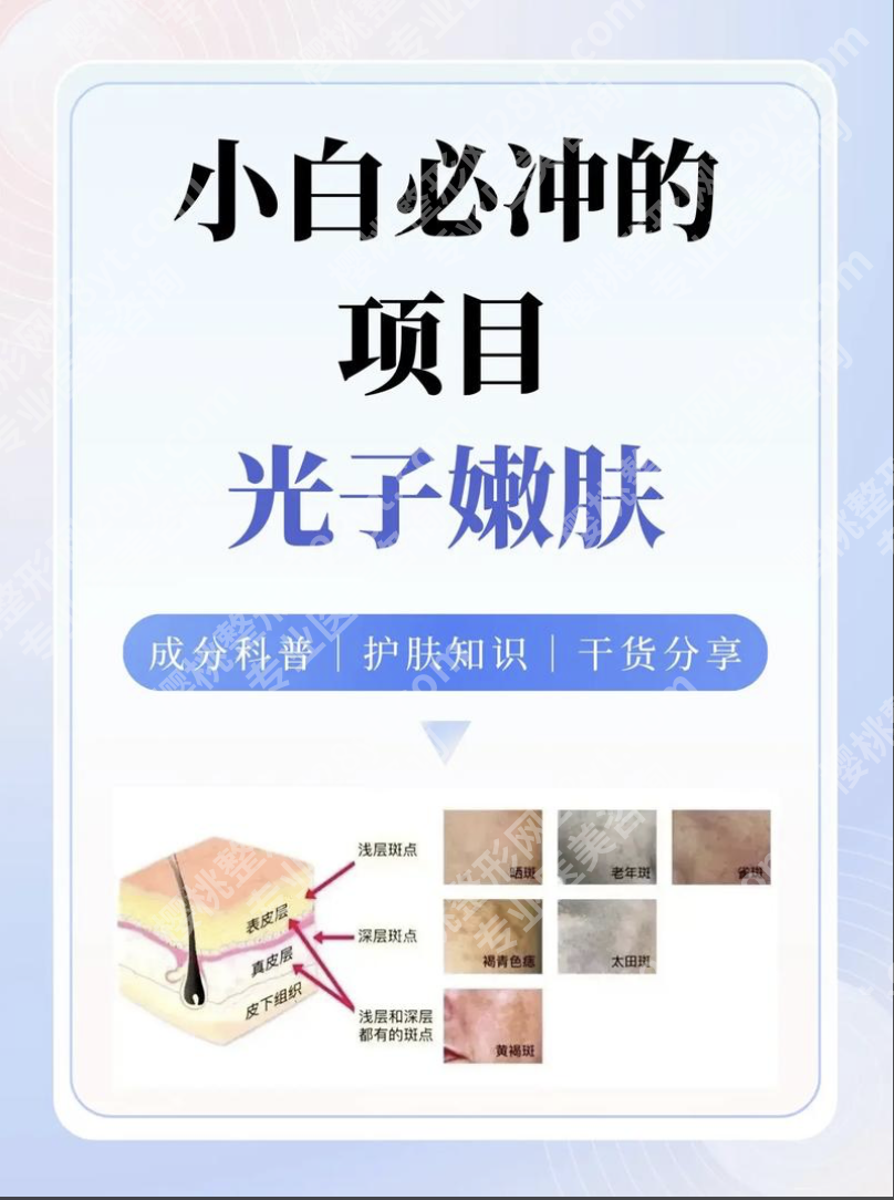 上海国际医学中心光子嫩肤怎么样？实测报告：从设备到效果的3大核心优势