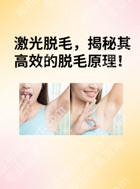 上海六院激光脱毛靠谱吗?价格、效果、避坑指南一次说清!