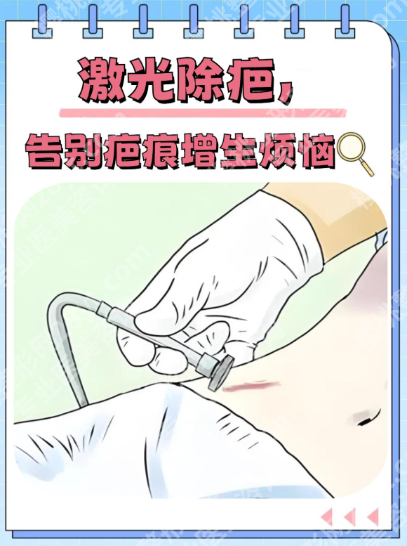上海六院去疤痕好不好？技术底气藏在这3点里