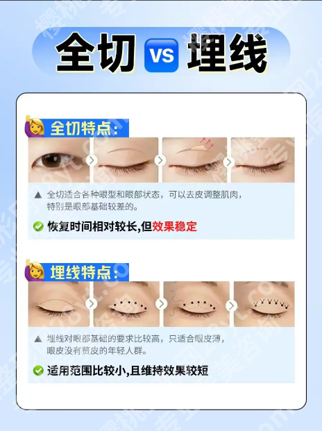 定点双眼皮和埋线哪个好？不是“谁比谁好”，而是“谁更适合你”