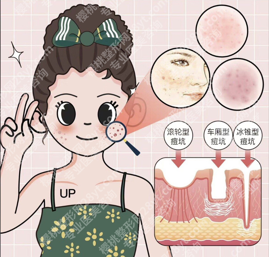 蚌医一附院点阵激光：三台王牌激光针对性