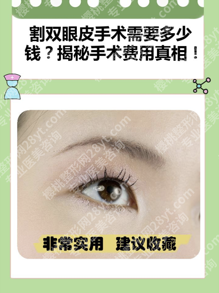 上海第一人民医院割双眼皮手术费用多少？来看省钱小技巧