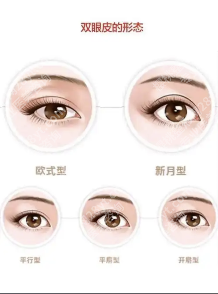 上海六院割双眼皮费用:揭开费用差异背后的真相
