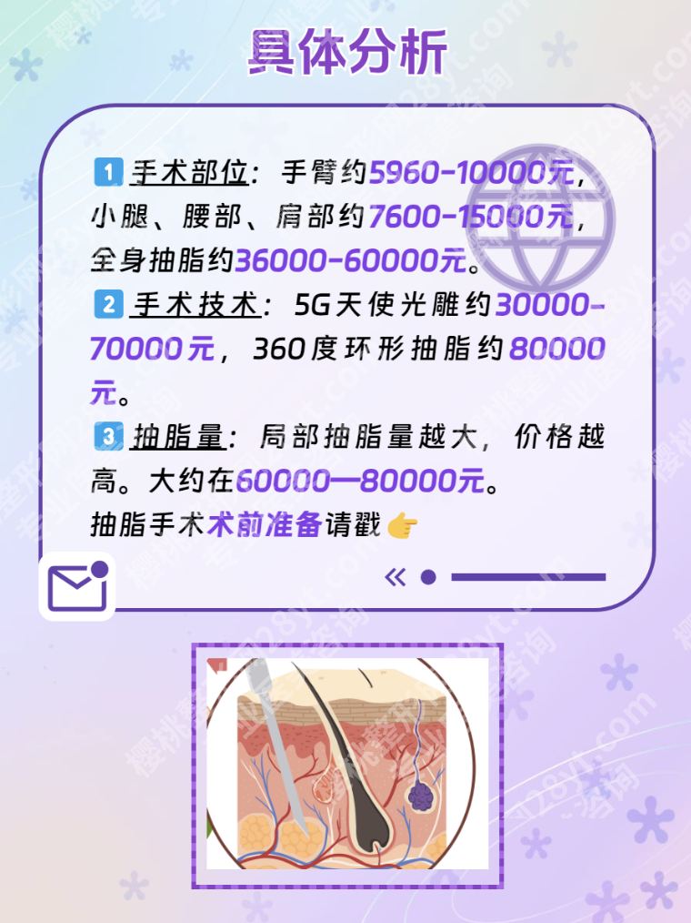 上海国际医学中心抽脂价格:不是“抽得越多越贵”,设备和医生才是关键