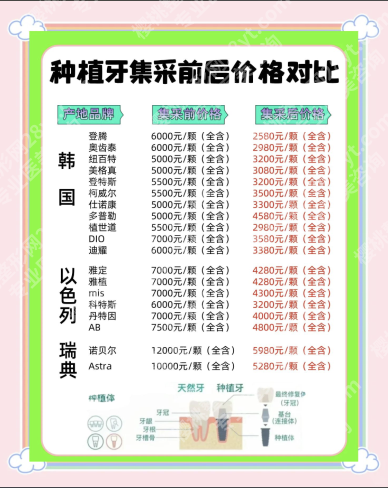 南充中心医院种植牙收费：2025年真实报价+种植体选择指南