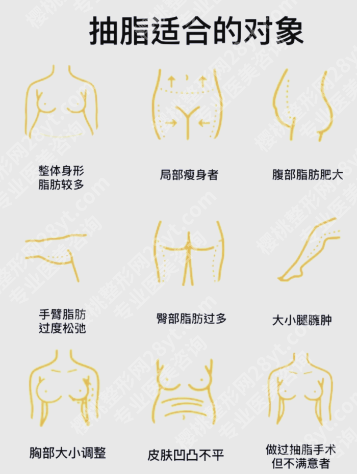 合肥大腿吸脂比较好的医院:2张表帮你快速对比选医院