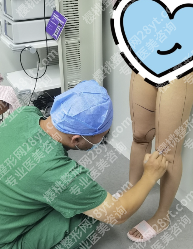 广州大腿吸脂的价格：“局部吸”vs“全腿吸”，差价能差2倍